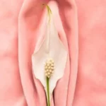 لابیاپلاستی در دختران باکره